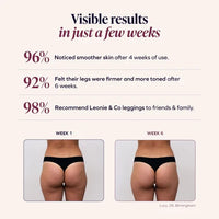 Rhoswen – 3D Anti-Cellulite Shaping Leggings