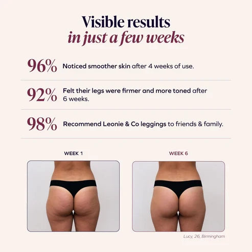 Rhoswen – 3D Anti-Cellulite Shaping Leggings